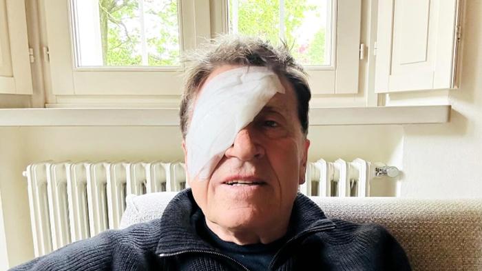 Gianni Morandi: Mistero dell’occhio bendato