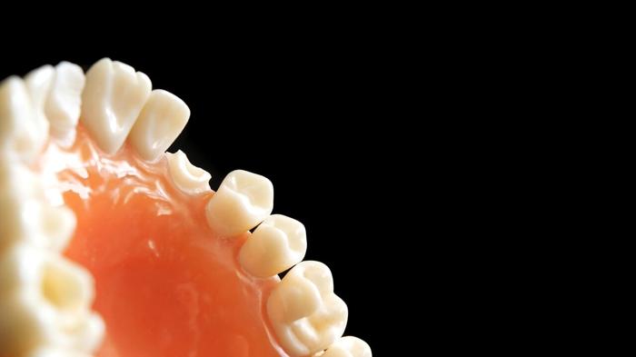 TRG035: Il Farmaco che Fa Ricrescere i Denti Mancanti