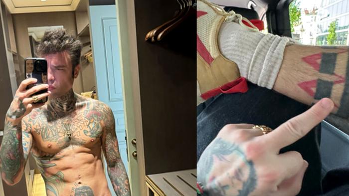 Fedez vs Codacons: Il Nuovo Capitolo della Disputa Legale