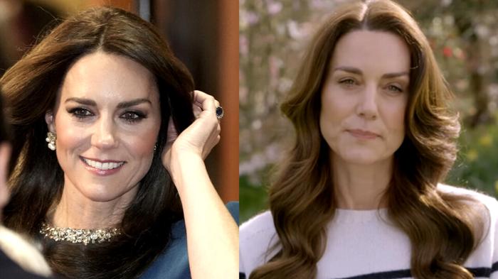 Kate Middleton: La sua battaglia contro la malattia