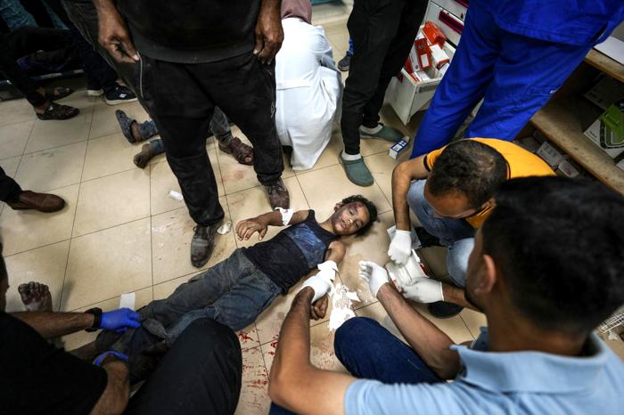 Un bambino palestinese ferito nei giorni scorsi. FOTO AP