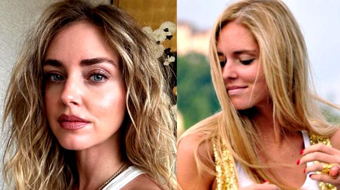 Chiara Ferragni: Analisi Ritocchi Estetici da Youaremylemonade