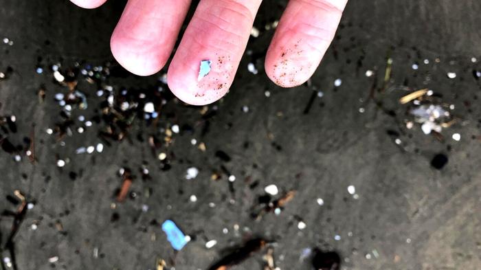 Microplastiche nel Pene Umano: Impatto sulla Salute Maschile