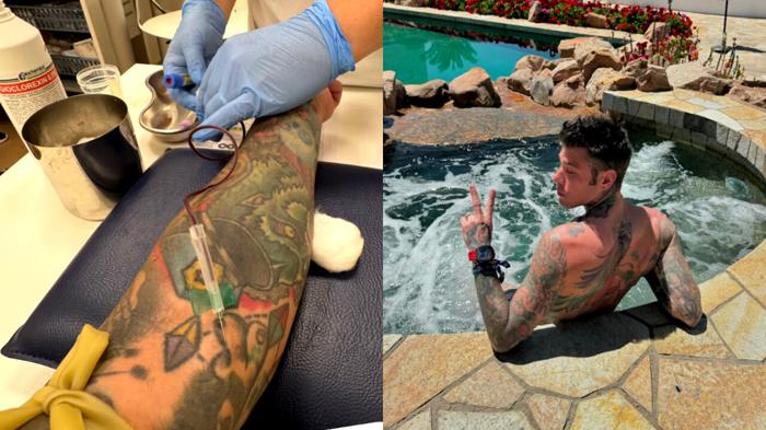 Fedez: Ricovero in ospedale e rassicurazioni su Instagram