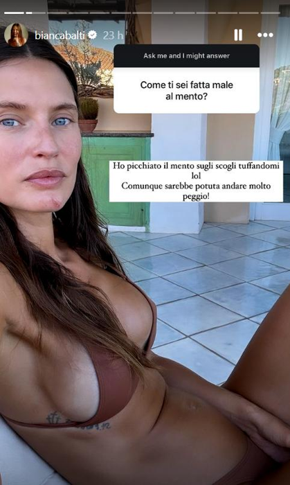 La storia di Bianca Balti 7