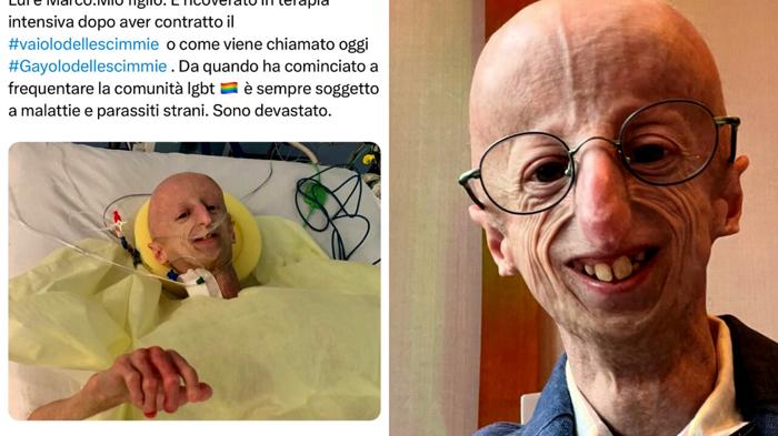 La vicenda di Sammy Basso: Fake News e Battaglia Contro l’Omofobia