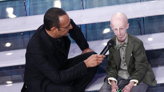 Addio a Sammy Basso: il coraggio di un combattente contro la progeria