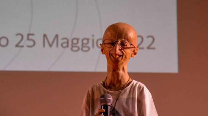 La progeria: la battaglia di Sammy Basso contro l’invecchiamento precoce